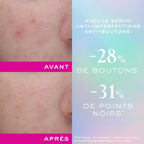 Nuxe Zinc Power Serum Anti-Imperfections 30ml